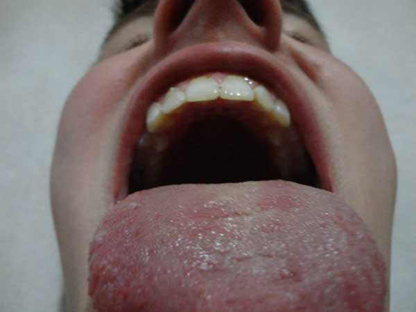 image32